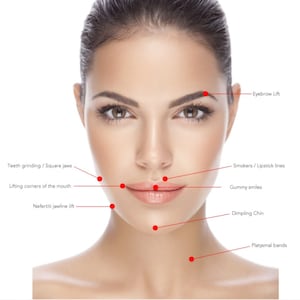 Advanced Botulinum Toxin full manual Digital Download