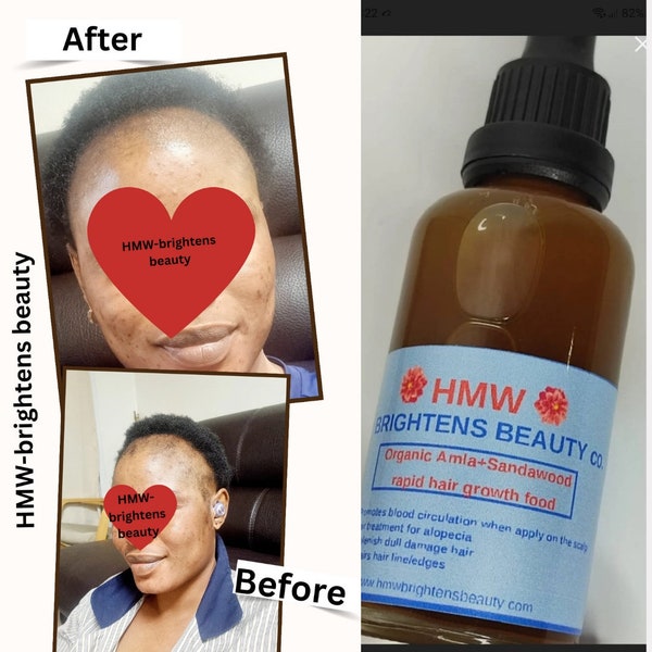 Organic amla+rosemary+ginseng hair growth oil 100% natural!