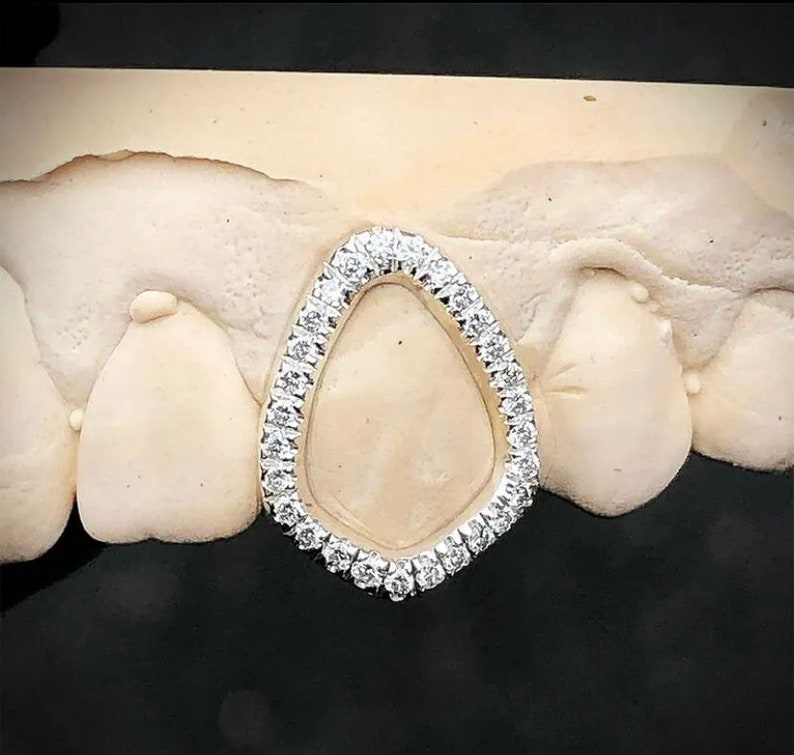 Custom Hollow Diamond Tooth Cap Etsy