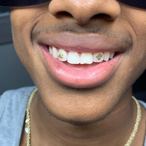 Weed Leaf & Diamond Shape (Real) tooth gems