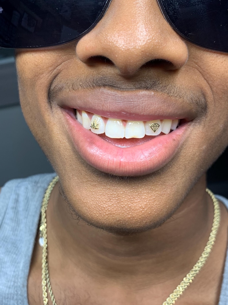 Weed Leaf & Diamond Shape (Real) tooth gems