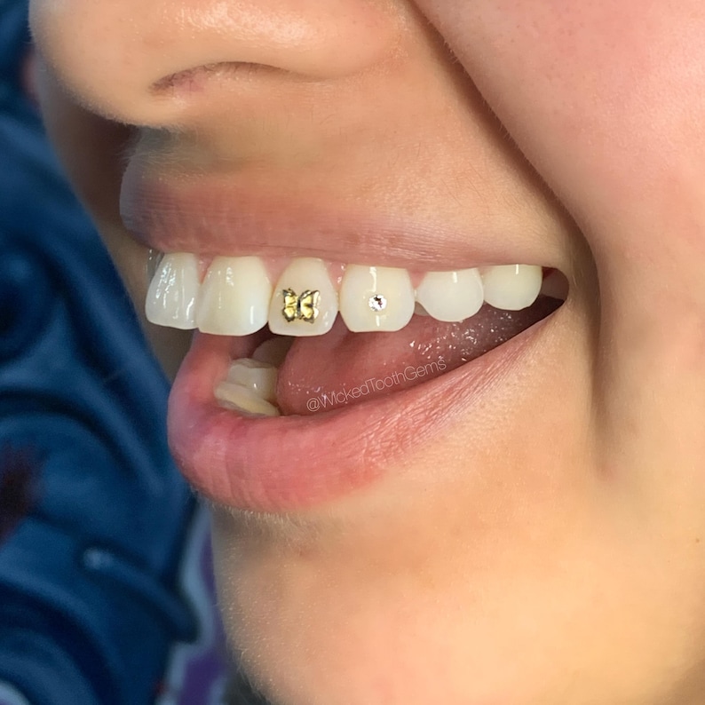 butterfly tooth gem
