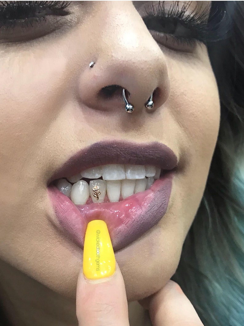 Rose Tooth Gem