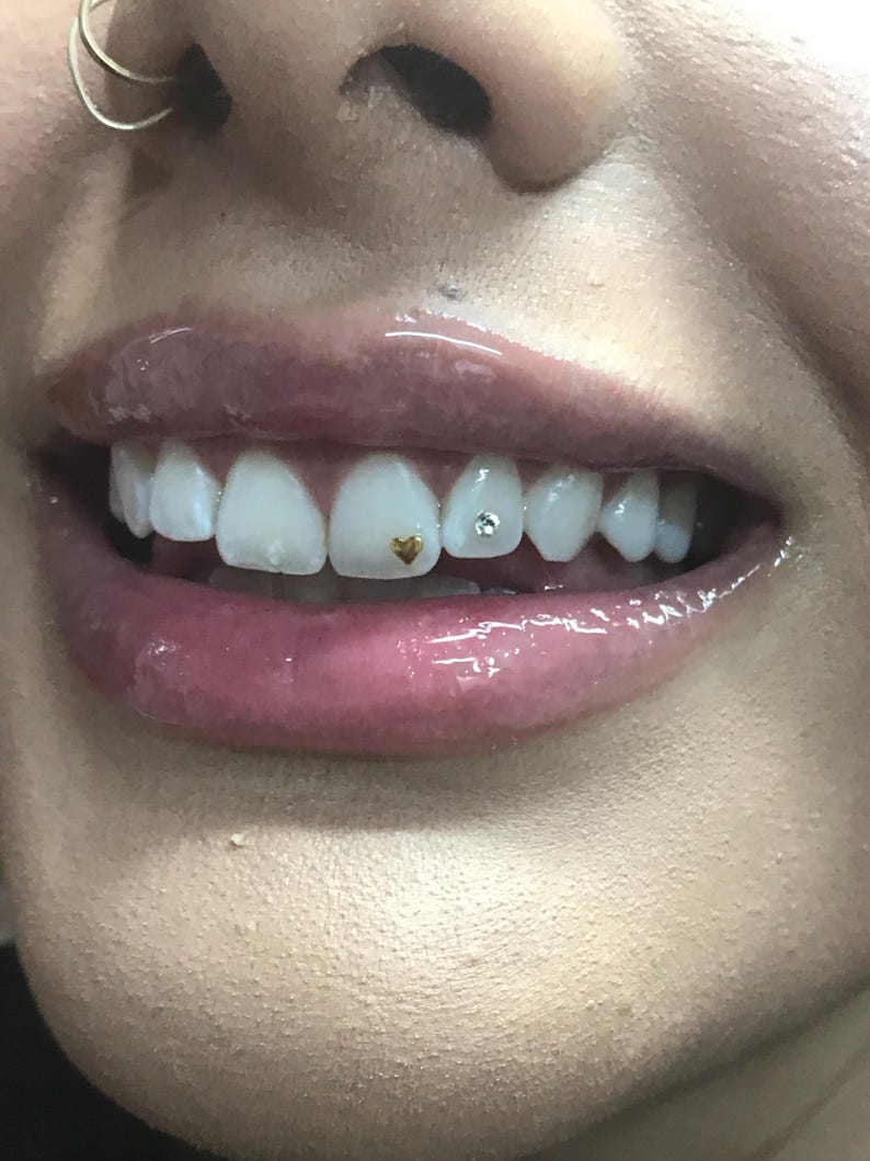 Tiny Heart tooth gem