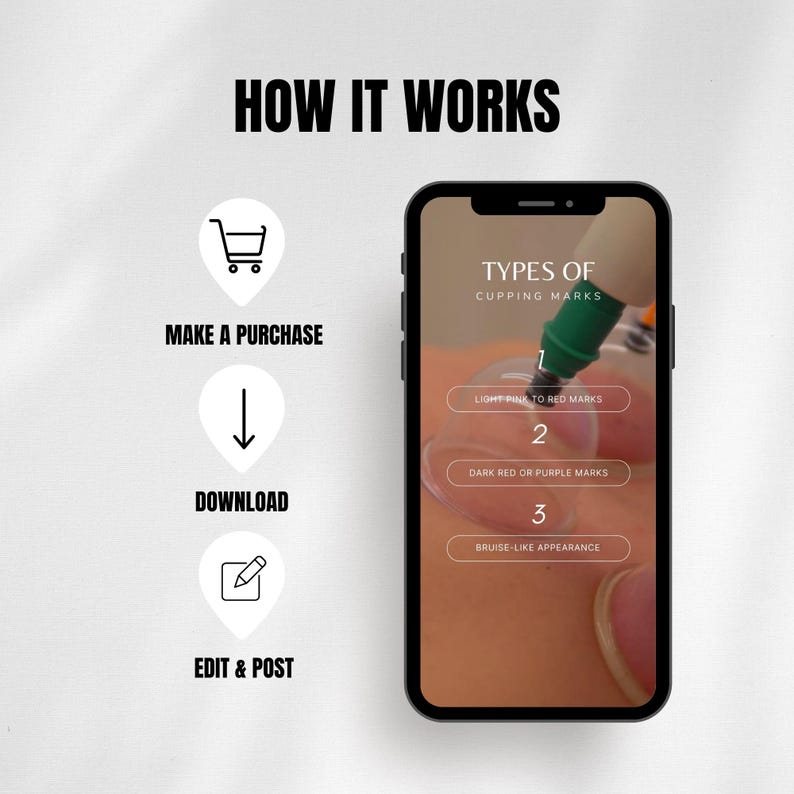 Mall för Instagram-rullar för koppterapi, Instagram-inlägg om holistisk hälsocoach, inlägg om alternativ medicin bild 10