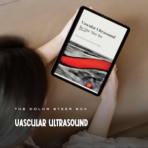 USG naczyń krwionośnych Kolorowy Doppler EBook Ultrasound Study Guide Vascular Cheat Sheet Ultrasound Tech Ultrasound Student Sonography