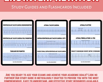 EKG & Dysrhythmie Interpretation + Lernkarten PDF - Instant Download
