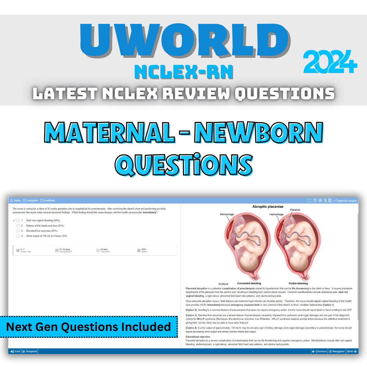 Uworld NCLEX-RN 2024 Maternal Newborn Questions - Etsy