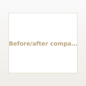 May include: A square graphic with a thin brown border on a light background. The text "Before/after compa..." is centered in the middle of the square in a bold, light brown sans-serif font, indicating a comparison layout for visual content.
