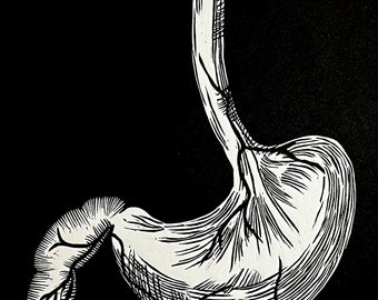 Linocut Print: Stomach (Ventriculus) - Anatomical Art