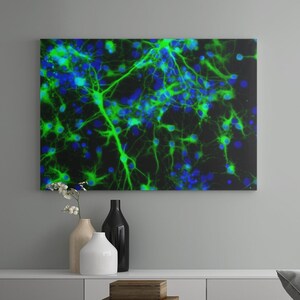 May include: A modern living room interior with a grey armchair, a coffee table, and a canvas print of a microscopic image of neurons in green and blue.