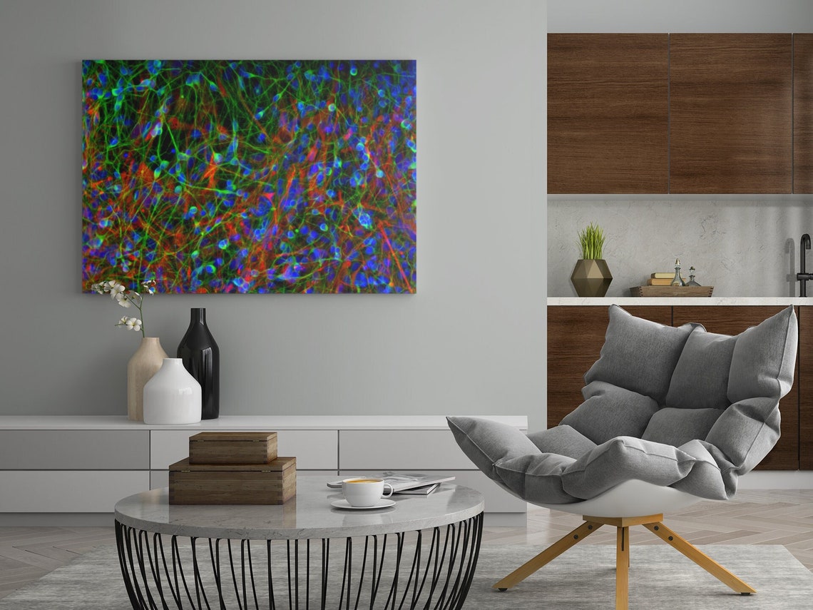 Human Ipscderived Neuronal Culture Art Print Confocal Micrograph by