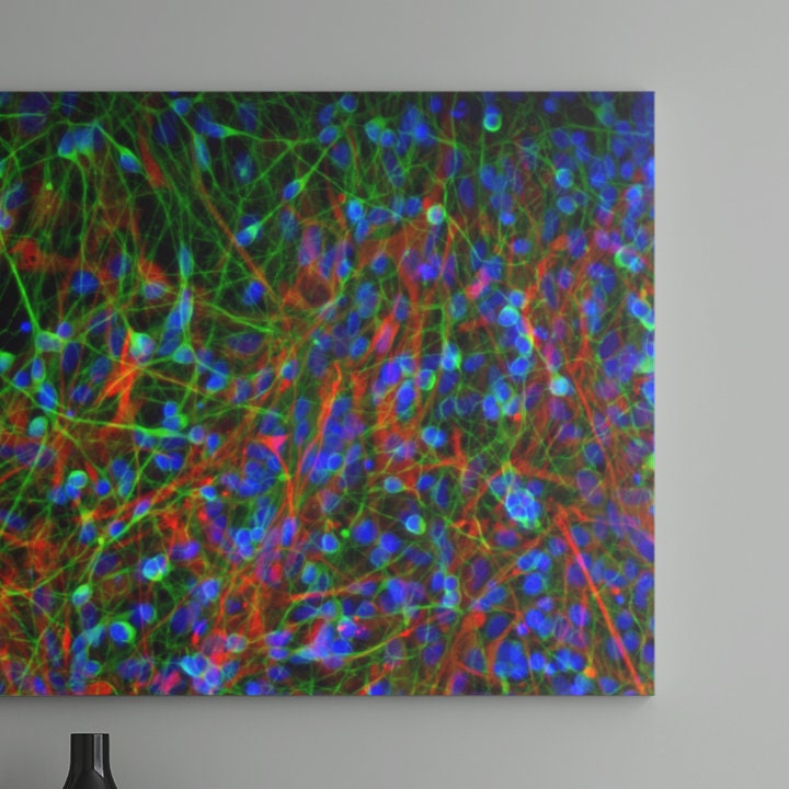 Human Ipscderived Neuronal Culture Art Print Confocal Micrograph by Rakesh Karmacharya