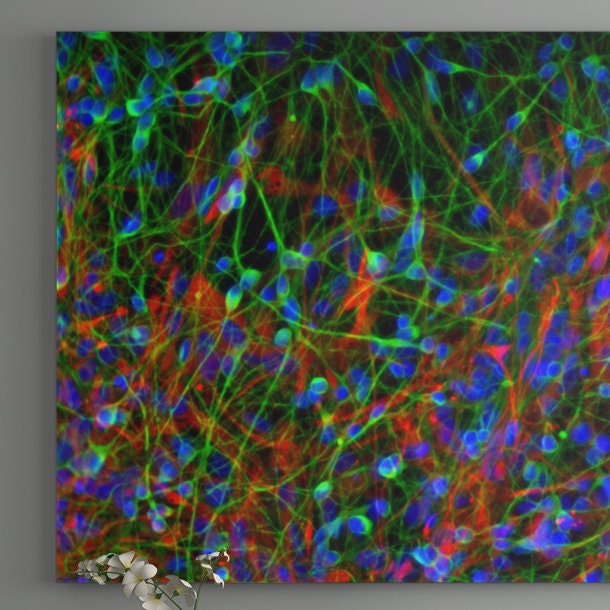 Human Ipscderived Neuronal Culture Art Print Confocal Micrograph by Rakesh Karmacharya