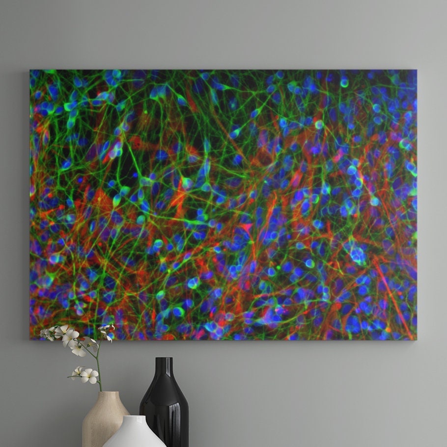 Human Ipscderived Neuronal Culture Art Print Confocal Micrograph by Rakesh Karmacharya