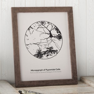 Pyramidal Neuron Micrograph Art Print: Hippocampus Anatomy