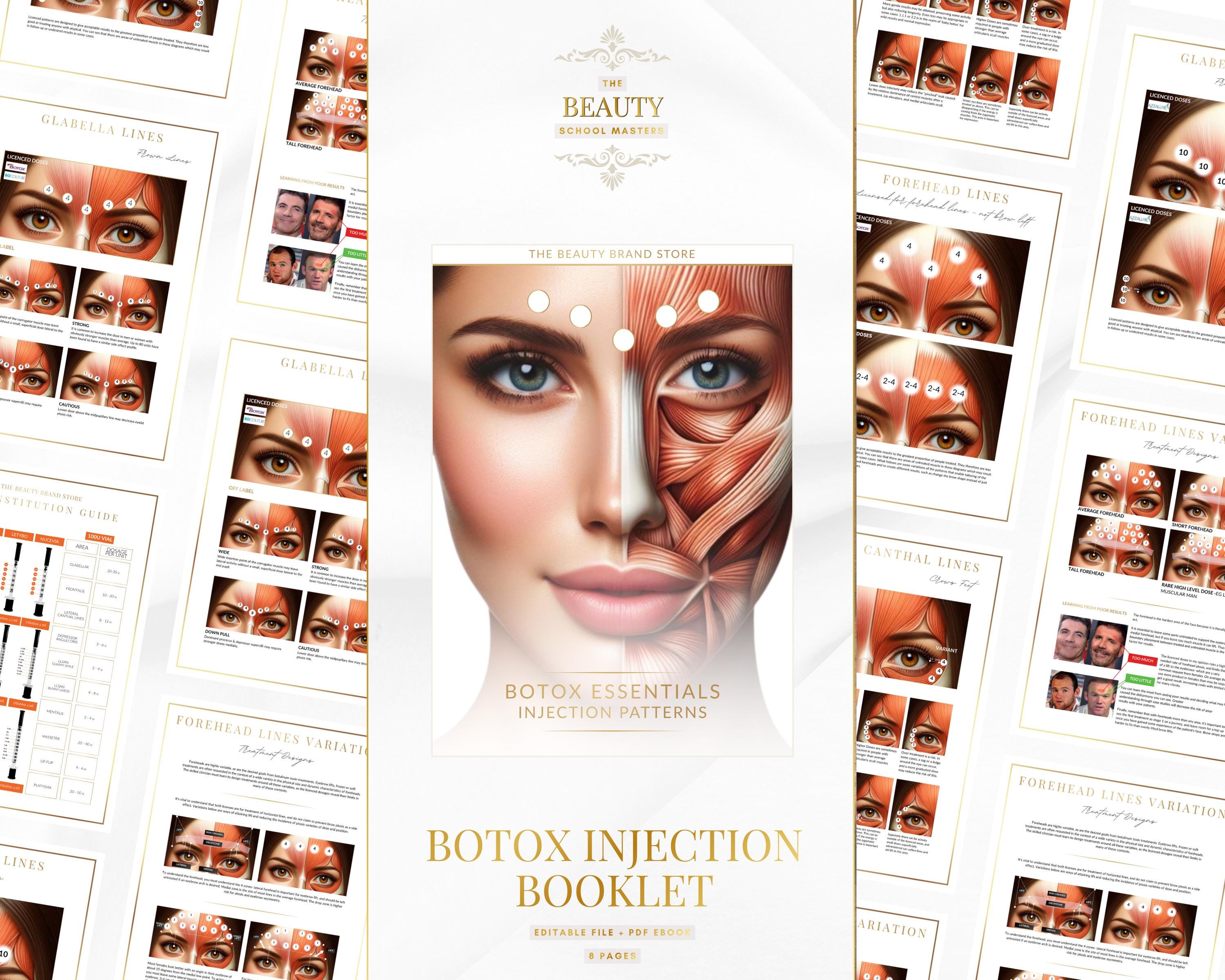 Printable Injection Guide Botox Injection Patterns Guide, Injector Training, Editable Printable ...