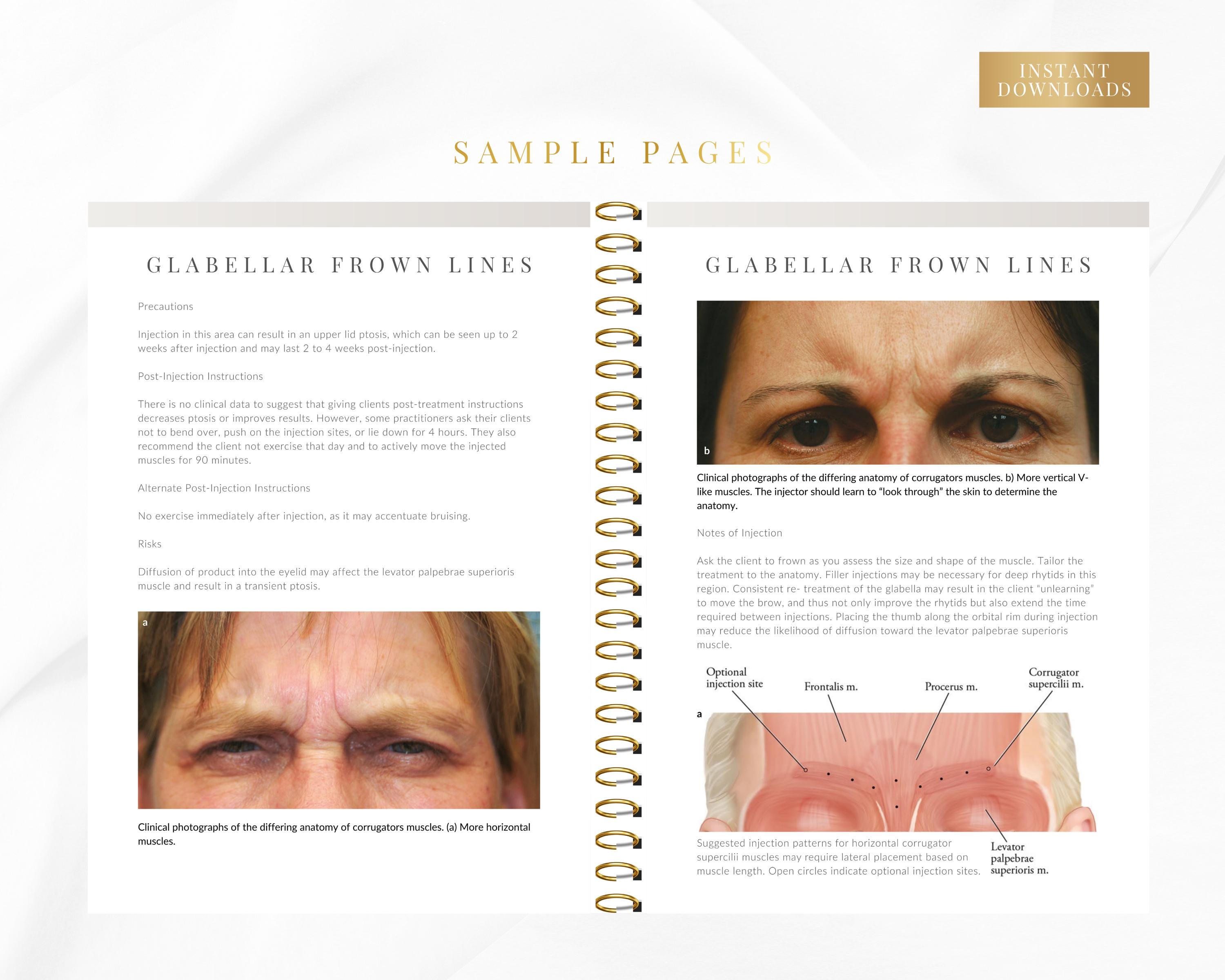 Botox Training Manual: Nurse Injector Neurotoxins Course (editable ...