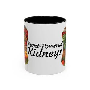 Accent Coffee Mug, 11oz