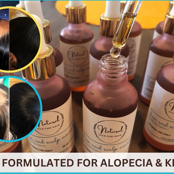 Alopecia Treatment Etsy