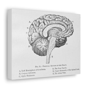 Brain Vintage Drawing Canvas Gallery Wraps