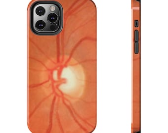 Optometry phone case Optometrist iphone case Ophthalmologist Retina phone case Eye doctor Gift for Optometrist Optic Nerve eye phone OD ONH