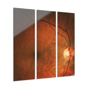 Optometrie kliniek kunst aan de muur voor optometrist kantoor & oogheelkunde oogarts decor netvlies OMD OD gift optische oog anatomie fundus foto