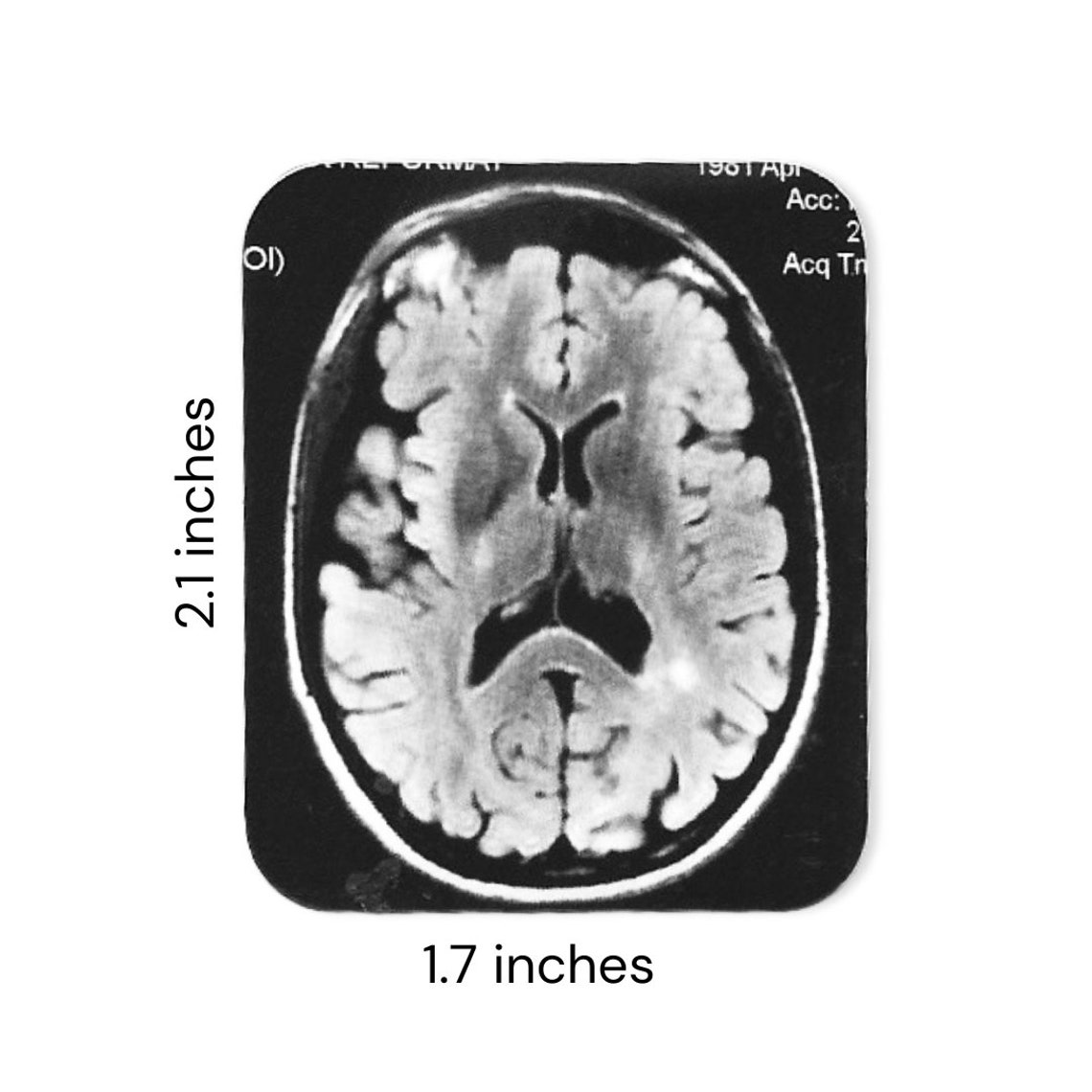 Mri Scanner Sticker MRI Brain Scan Multiple Sclerosis Handmade STICKER - Etsy