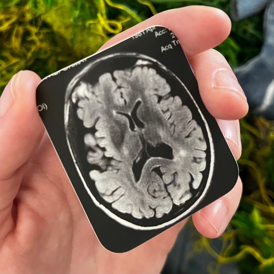 Mri Scanner Sticker MRI Brain Scan Multiple Sclerosis Handmade STICKER - Etsy