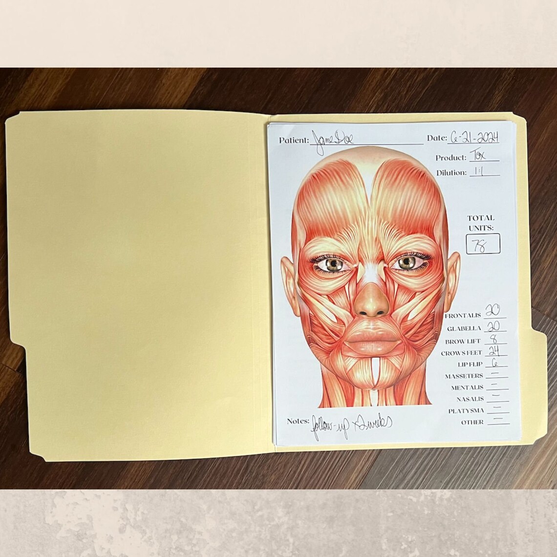 Charting Injector Face Aesthetic Injector Treatment Template Notepad Easy Tear-away Notebook ...