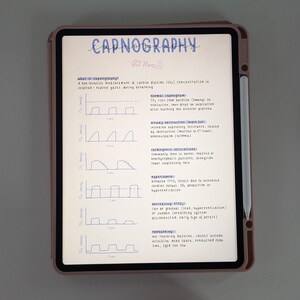Capnography Poster for Veterinary Nurses Anaesthesia Vet Student Revision Resources