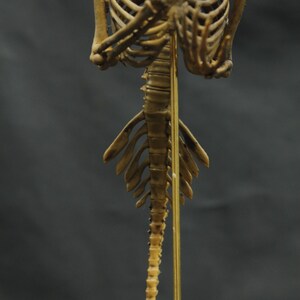 May include: Anatomical model of a human skeleton, showing the rib cage, spine, and shoulder structure. The model is tan, with a dark grey background. The spine is supported by a thin, gold-coloured rod.