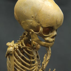 May include: A detailed anatomical model of a human skeleton in a thoughtful pose. The model is a light tan colour, with the skull and rib cage clearly visible. The figure is posed with a hand on the chin, suggesting contemplation.