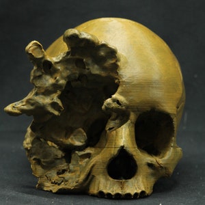 Replica of an exploded human skull - MADE TO ORDER