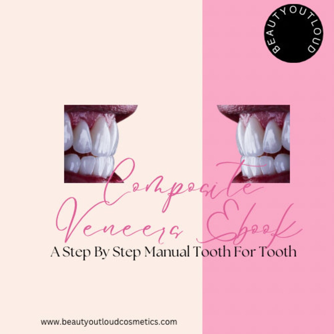 Step by Step Composite Veneers - Etsy