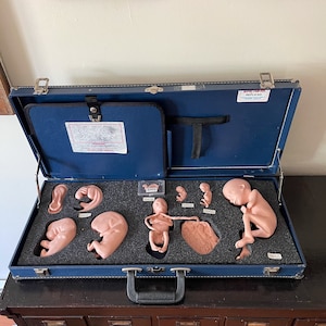 May include: A blue carrying case with a black handle, containing a set of fetal development models. The models are made of a light pink material and show different stages of fetal growth. The case has a label that reads "REPLICAS".