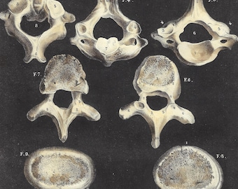 1844 Anatomical Antique Print Skeleton Wall Art Human Bones Vintage Medical Gift Print Office Decor Clinical Art Vertebrae Spine Backbone