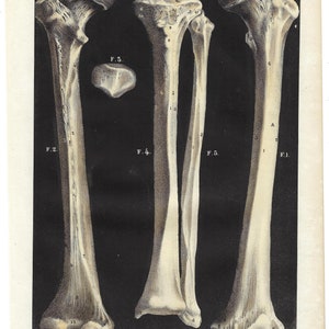 1844 ANATOMY Print Original Antique Print LEG BONES Lithograph Clinic Decor Human Body Print Medical gift Anatomical Wall Art Medicine