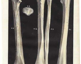 1844 Antique Anatomy Print Vintage Leg Bones Lithograph Clinical Wall Decor Medical Gift