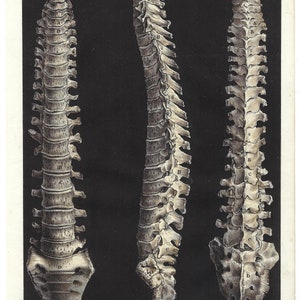 1844 Anatomical Antique Print Skeleton Wall Art Human Bones Original Medical Gift Print Office Decor Clinical Artwork Spine Backbone