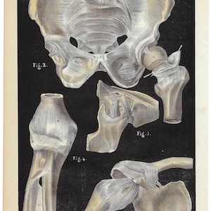 1844 ANATOMY Print Original Antique Print JOINT BONES Lithograph Clinic Decor Human Body Print Medical gift Anatomical Wall Art Medicine
