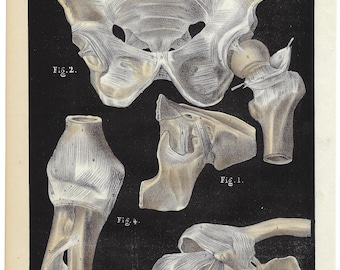 1844 Antique Anatomy Print Vintage Joint Bones Lithograph Clinical Wall Art Human Body Print Medical Gift