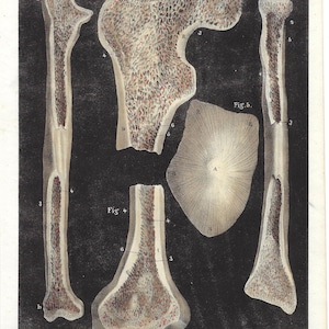 1844 - Antique ANATOMY Print Medical Wall Art Clinical Decor Vintage Human Body Print Physiology Doctor Gift Vintage Traumatology Skeleton