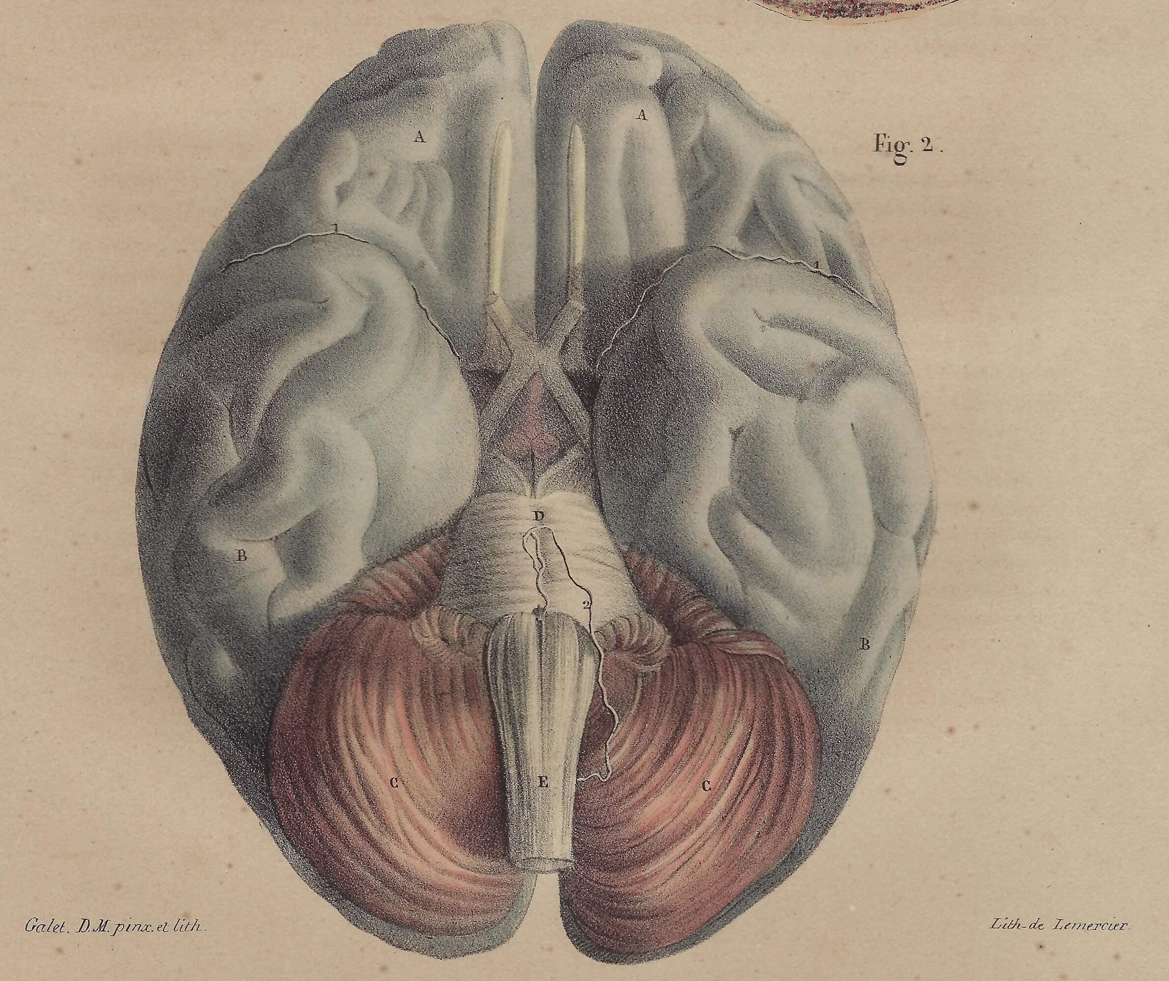 1854 - ヴィンテージ解剖学プリント脳壁アート医療アートワーク