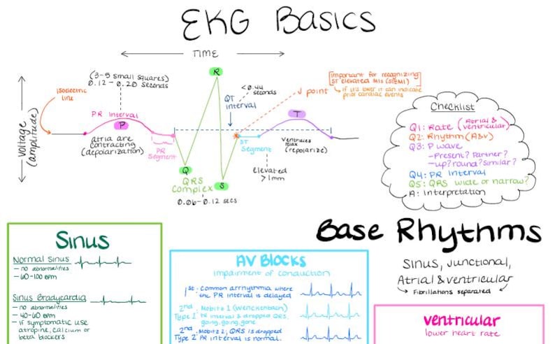 Ekg Visual Function EKG Basics: Colorful Handwritten Notes (digital Download) - Etsy