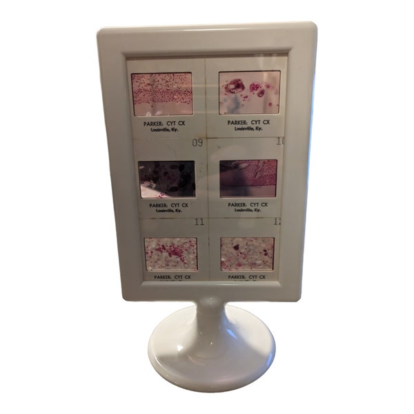 Framed Display of Medical, Pathology Slides