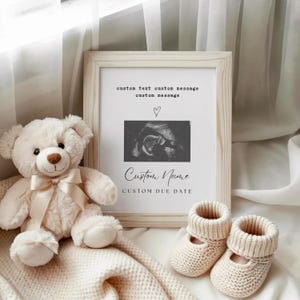 Impresión fotográfica de ultrasonido personalizada, anuncio de embarazo, recuerdo, ecografía, baby shower, regalos de revelación, marco de revelación de ultrasonido, regalo
