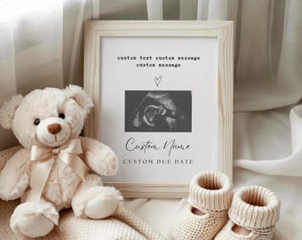 Personalized Ultrasound Photo Print Pregnancy Announcement Keepsake Sonogram Baby Shower Reveal Gifts Ultrasound Reveal Frame Gift