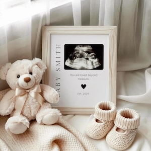Puede incluir: Una imagen de ultrasonido enmarcada con el texto "BABY SMITH" y "You are loved beyond measure." Un osito de peluche, una manta y unos patucos de bebé de punto están junto al marco. El año estimado es 2026.
