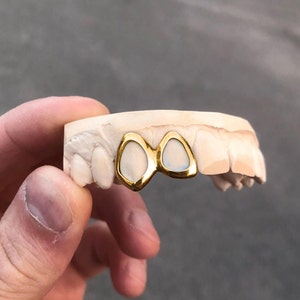 GRILLZ Open design model, custom made double teeth, for men, for women, dental putty kit included, silver/gold/golden alloy grillz tooth cap image 3